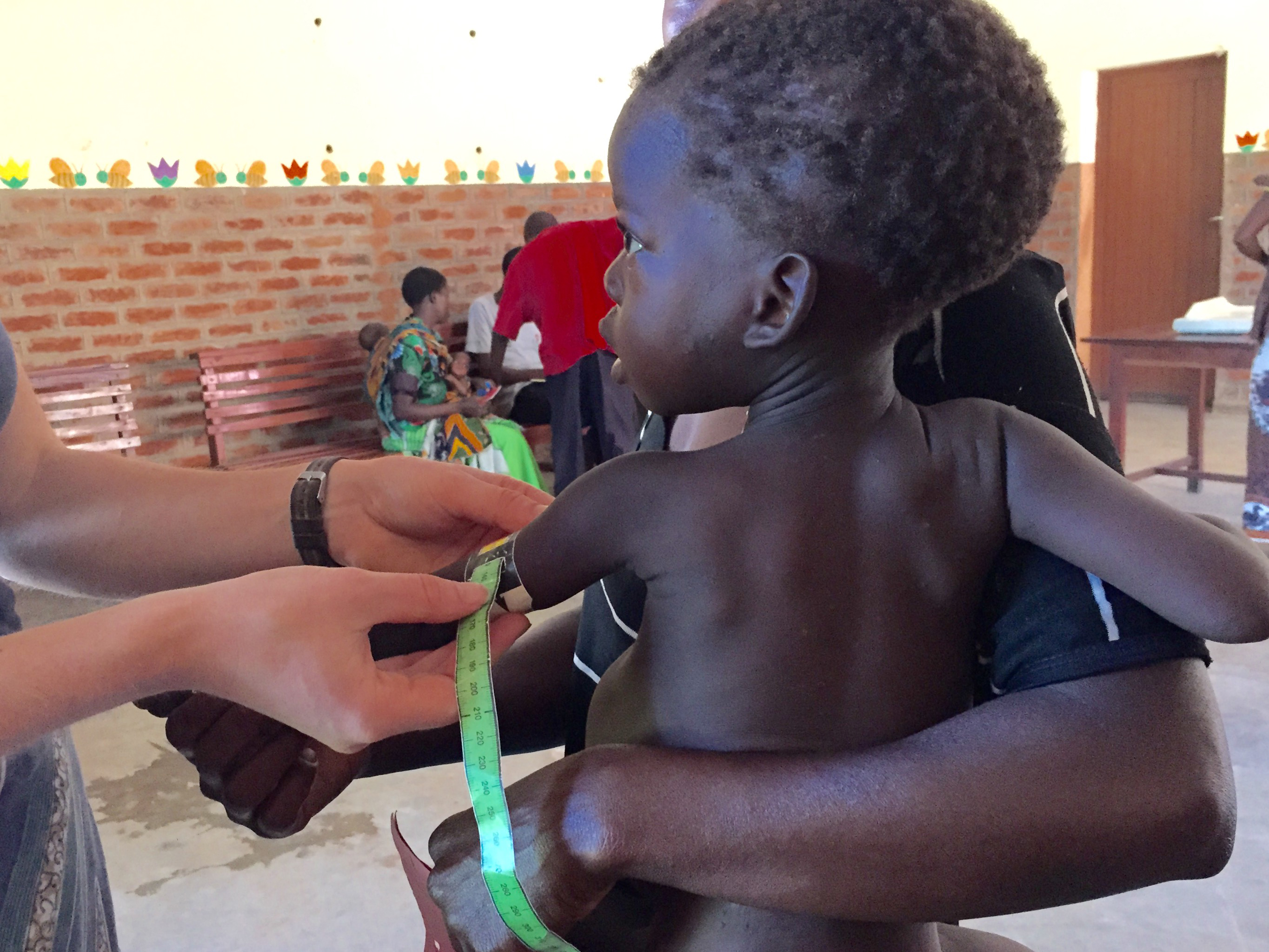 Study: Right gut bacteria may protect against malnutrition