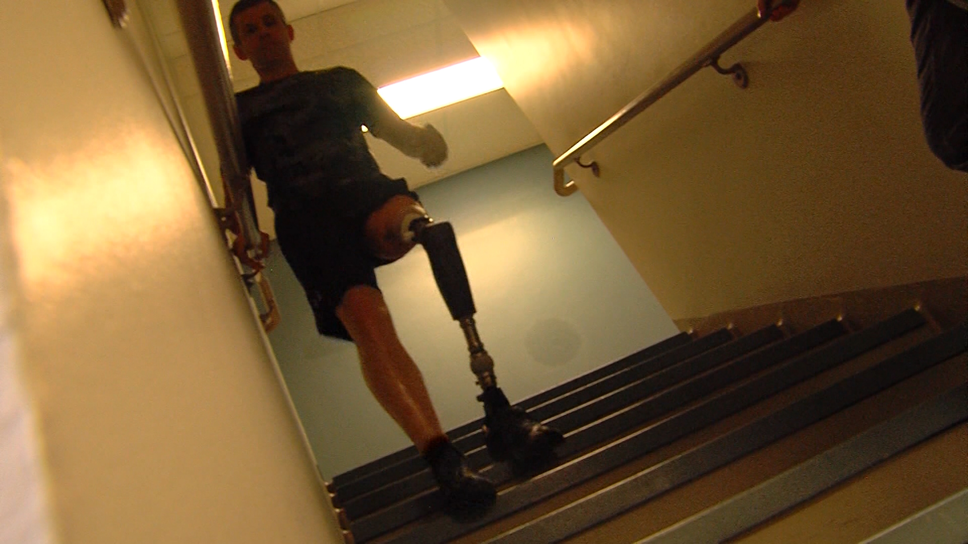 Veteran amputees begin using first ever prosthetic implants
