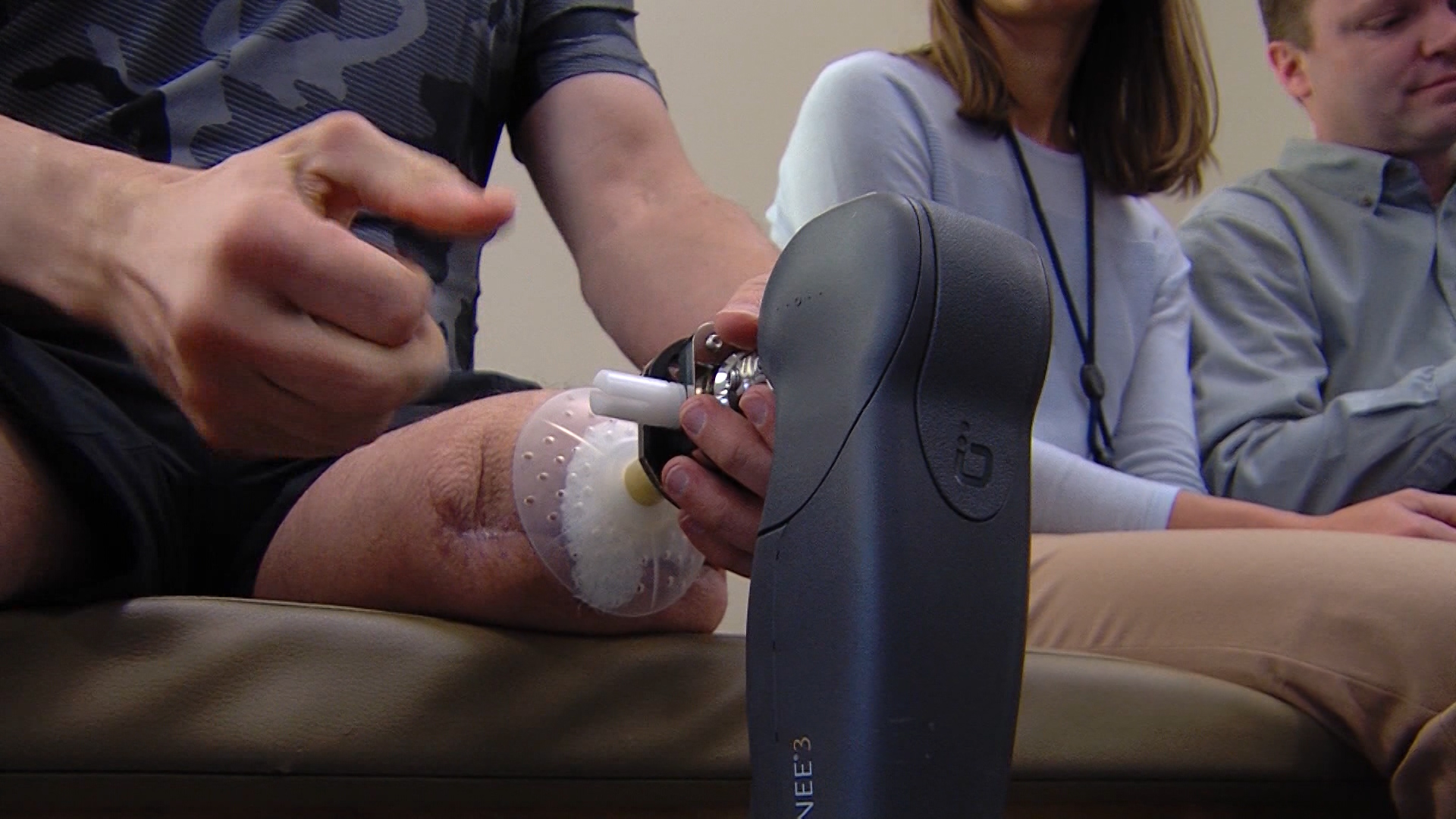 Veteran amputees begin using first ever prosthetic implants