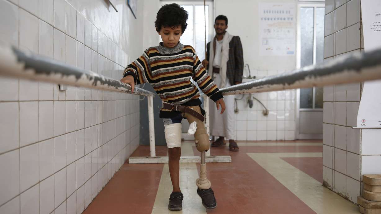 An infant's 5-month life points to hunger's spread in Yemen