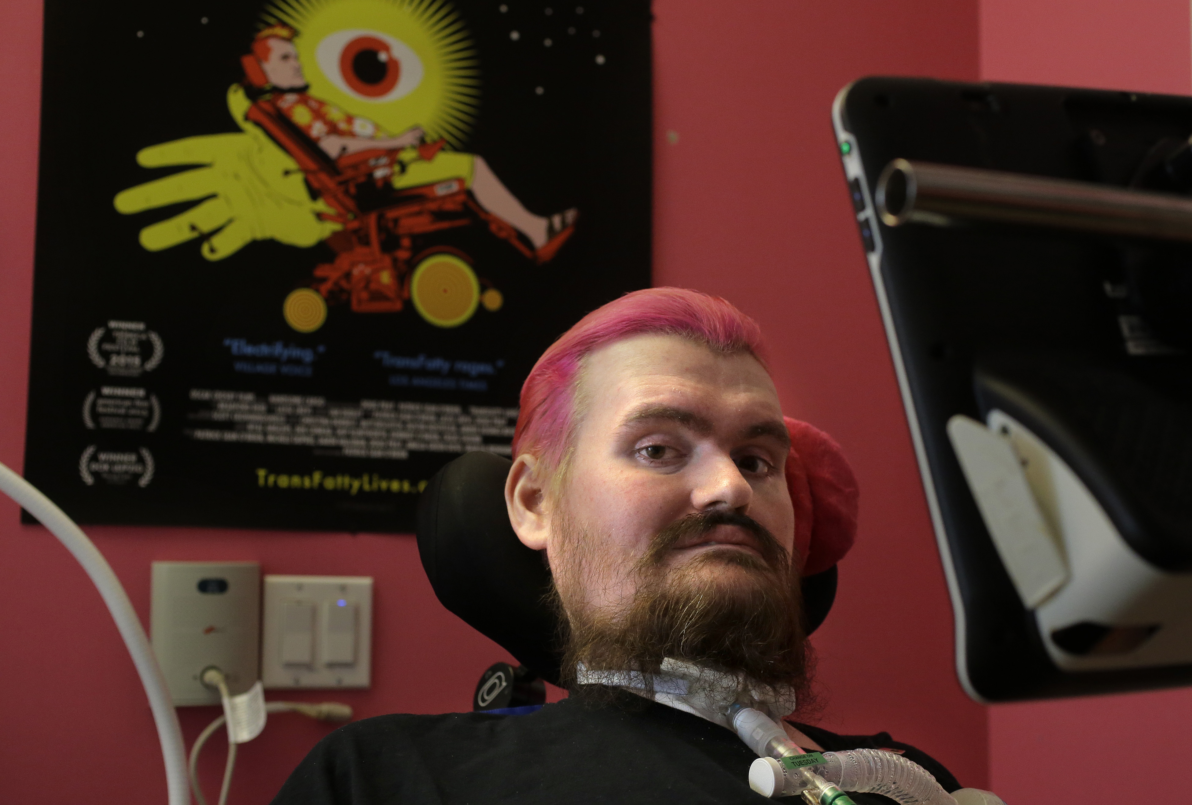 Using just his eyes, filmmaker captures his fight with ALS