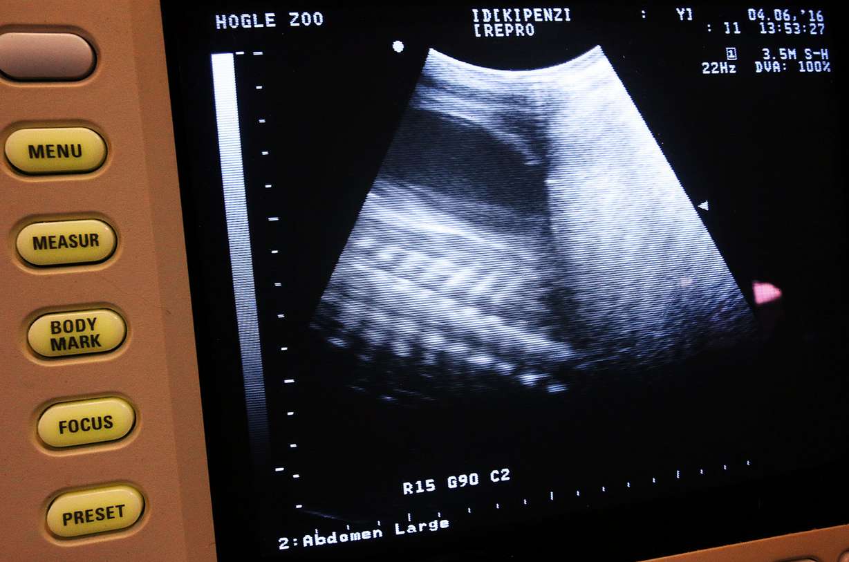 A baby giraffe spine can be seen during an ultrasound on Kipenzi, a giraffe at Utah's Hogle Zoo, in Salt Lake City on Wednesday, April 6, 2016. (Photo: Ravell Call, Deseret News)