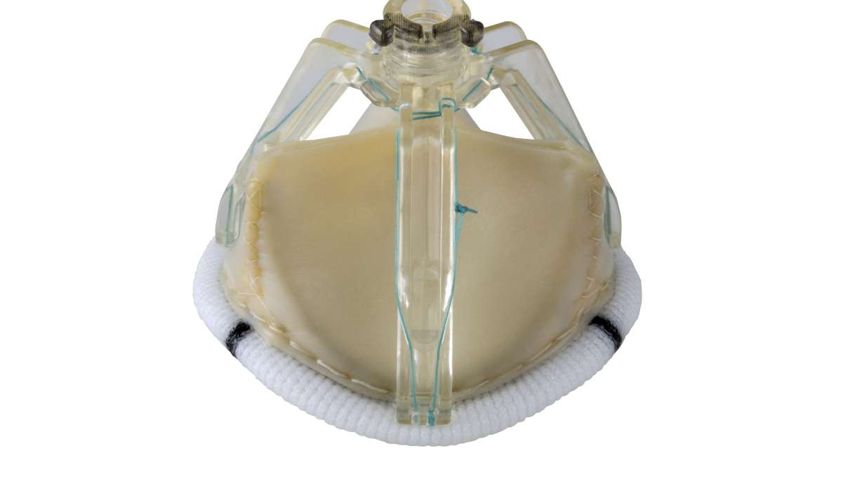 St. Jude Medical Announces the European Launch of the Trifecta Surgical Valve with Glide Technology to Improve Options for Patients in Need of Aortic Valve Replacement
