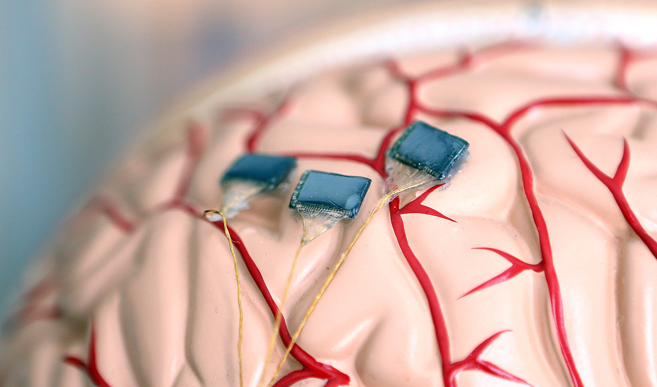 An example of an electrode array and a transmitter device are placed in a plastic model of a head at the offices of Blackrock Microsystems in Research Park in Salt Lake City, Wednesday, April 20, 2016. (Photo: Chris Samuels, Deseret News)
