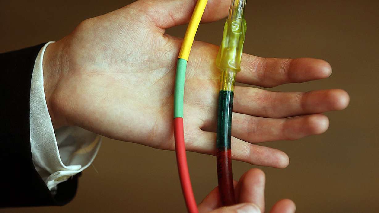 U. students, doctor develop device to make intubation easier on patients