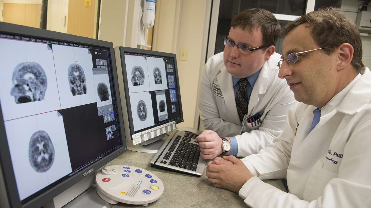 Brain scans find protein a marker of Alzheimer's decline