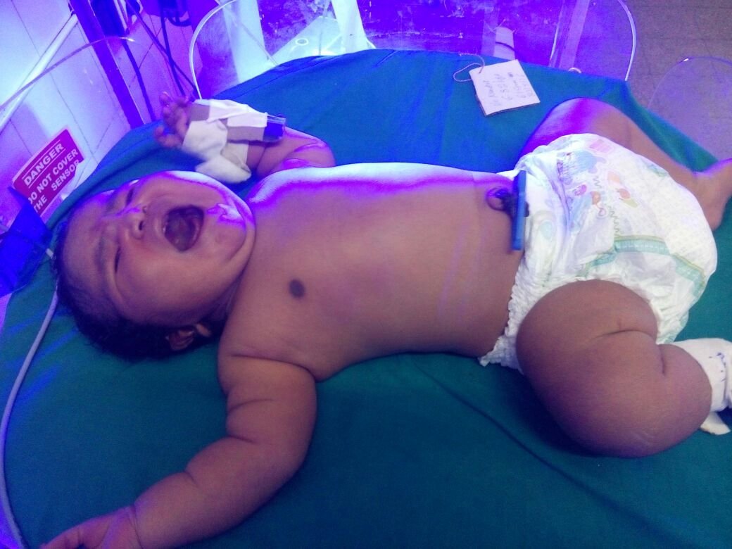 Teen delivers 15-pound baby in India