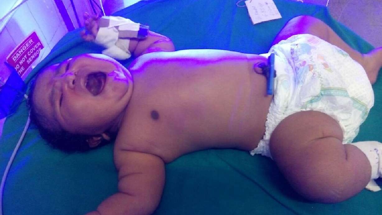 Teen delivers 15-pound baby in India