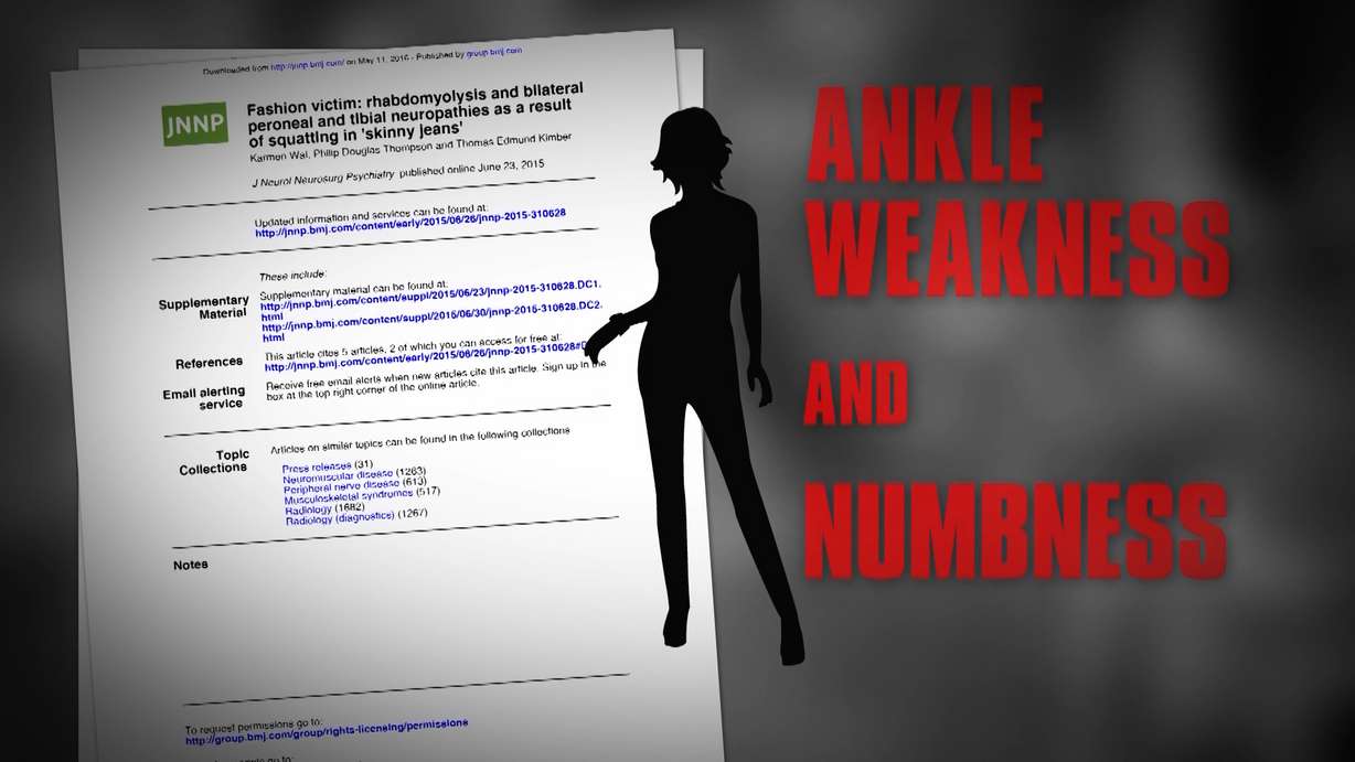 Millions of women wear shapewear to stay trim. It's the modern answer to the girdle. But there are some health risks you should be aware of. Here's the skinny on compression clothing.