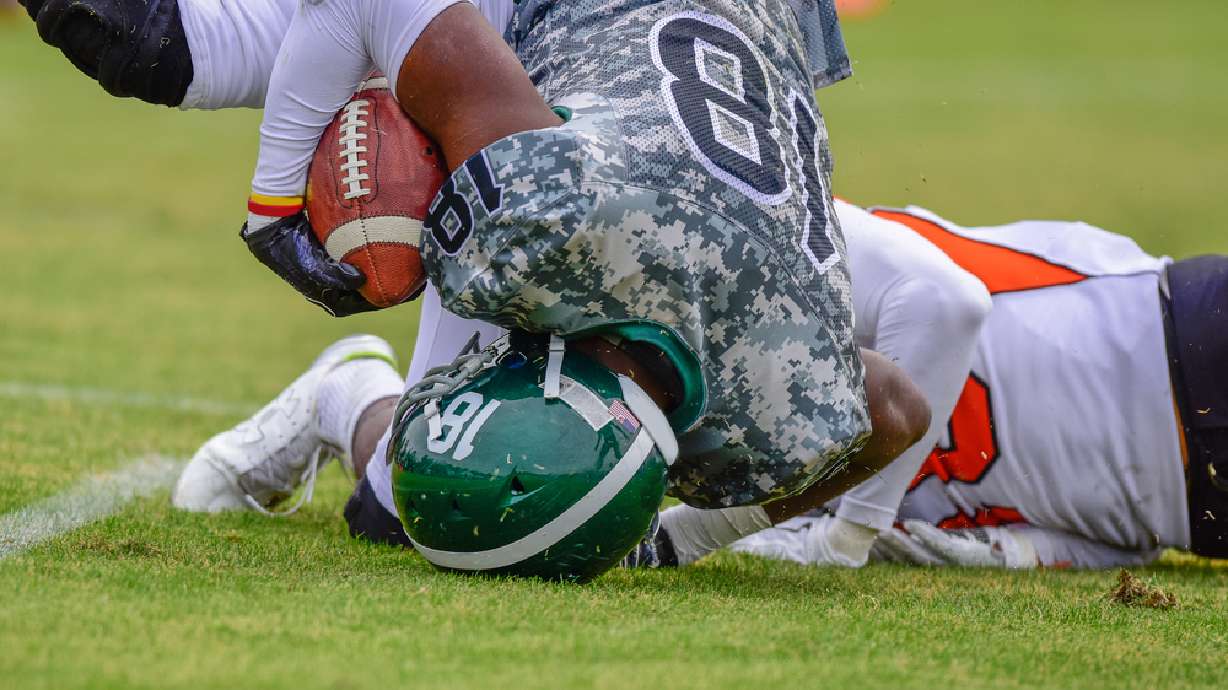 US kids get 2M concussions a year from sports, play