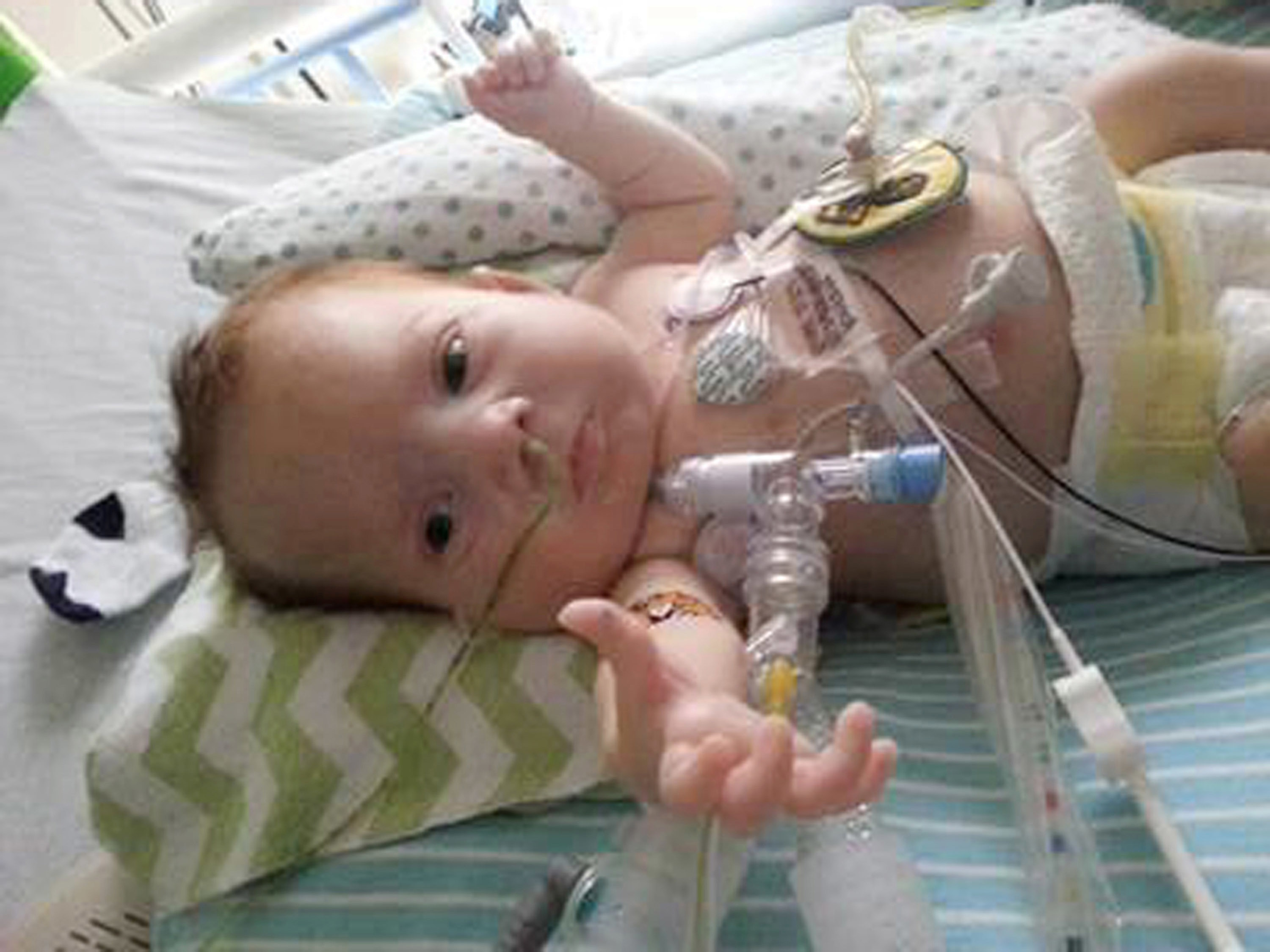 Severe birth defects not as lethal as docs once said: Study