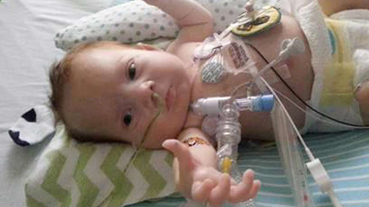 Severe birth defects not as lethal as docs once said: Study