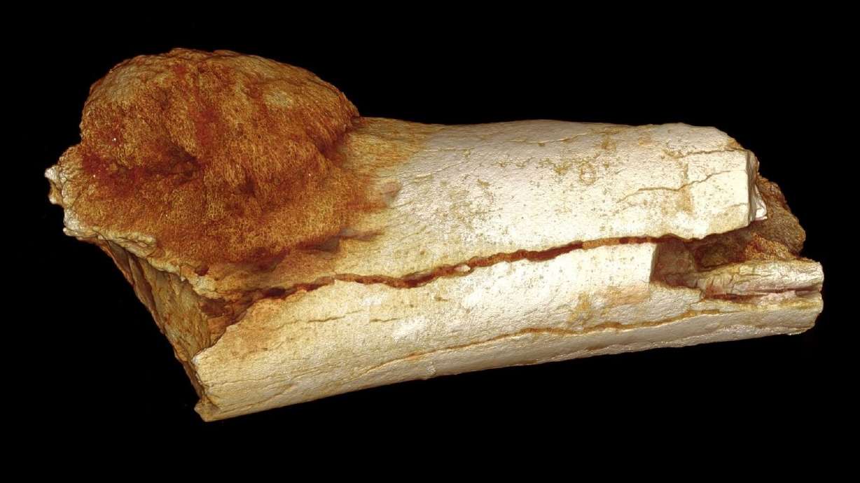 Scientists find cancer in million-year-old fossil