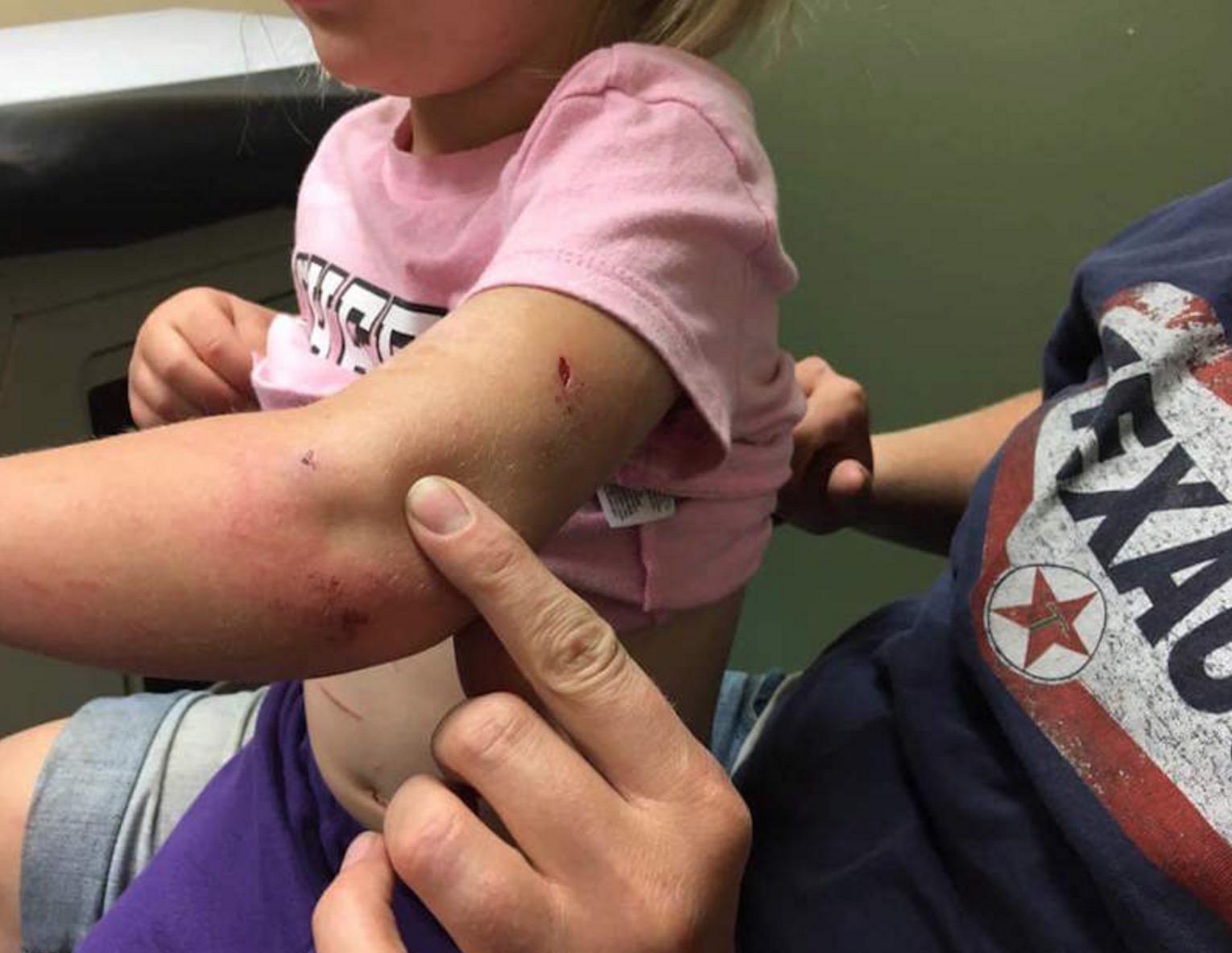 Family saves 4-year-old girl from mountain lion attack in Idaho