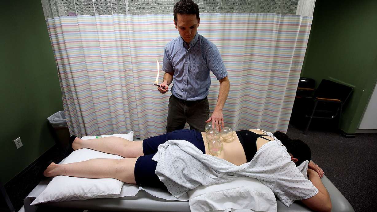 Cupping therapy used by Olympic athletes showcases ages-old practice