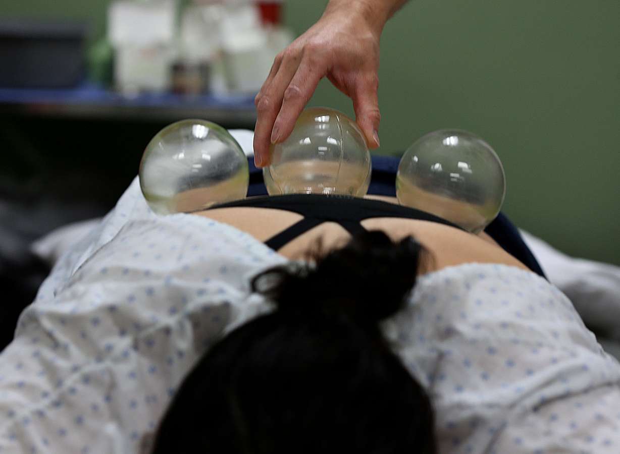 Tyehao Lu applies cups to Maria's back at Master Lu's Health Center in Salt Lake City on Thursday, Aug. 11, 2016. Maria has pain in her lower back due to a herniated disc. (Photo: Laura Seitz, Deseret News)