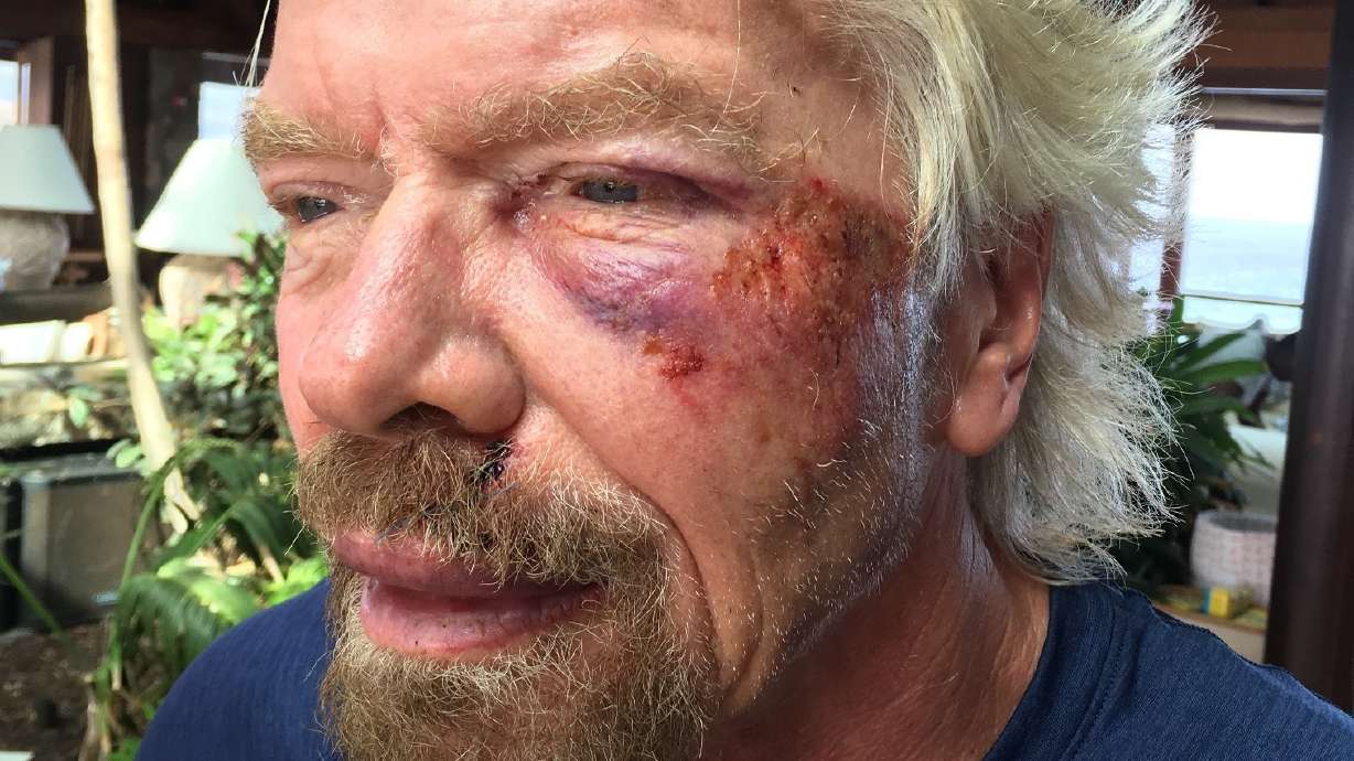 Billionaire Richard Branson survives bike crash