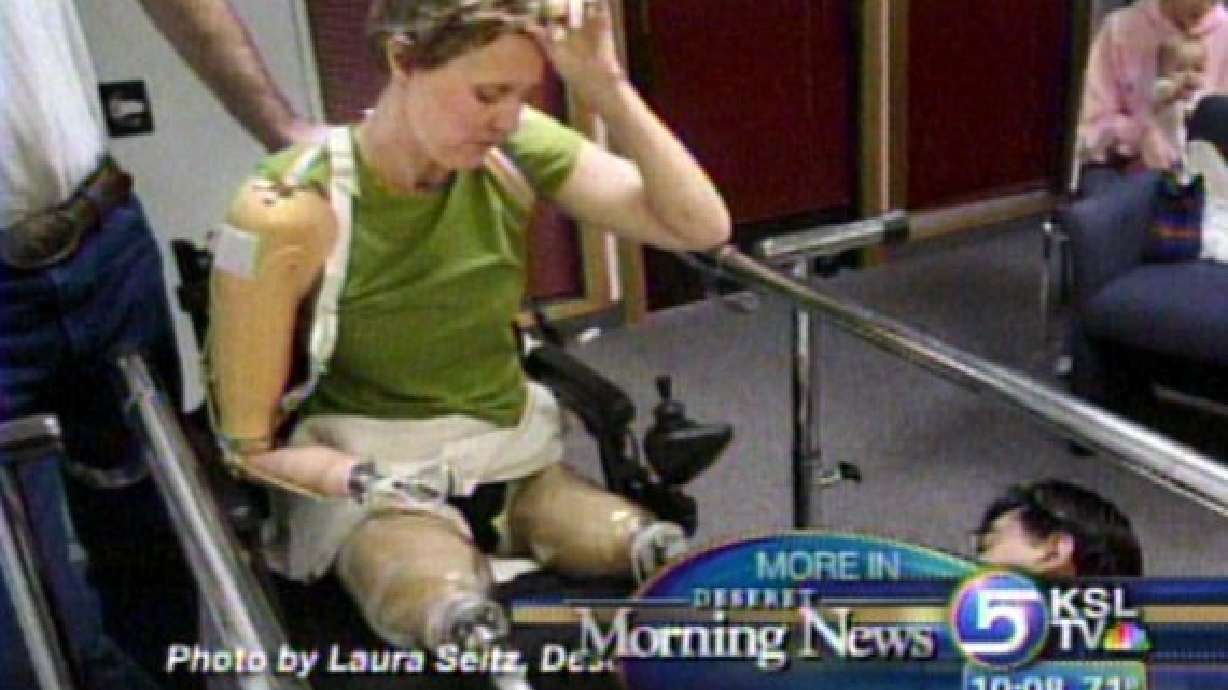 Woman Sues After Losing Limbs to Infection