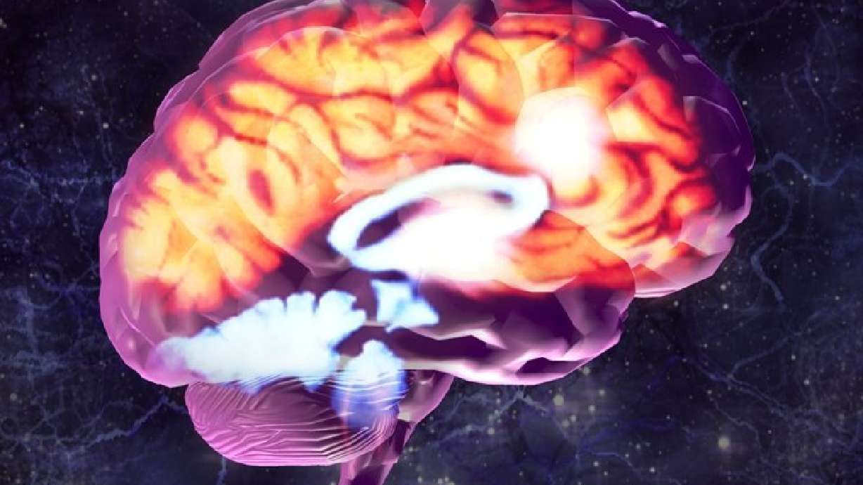 Extra Lumpy Brain You're an adult, but your brain might not be, experts say | KSL.com