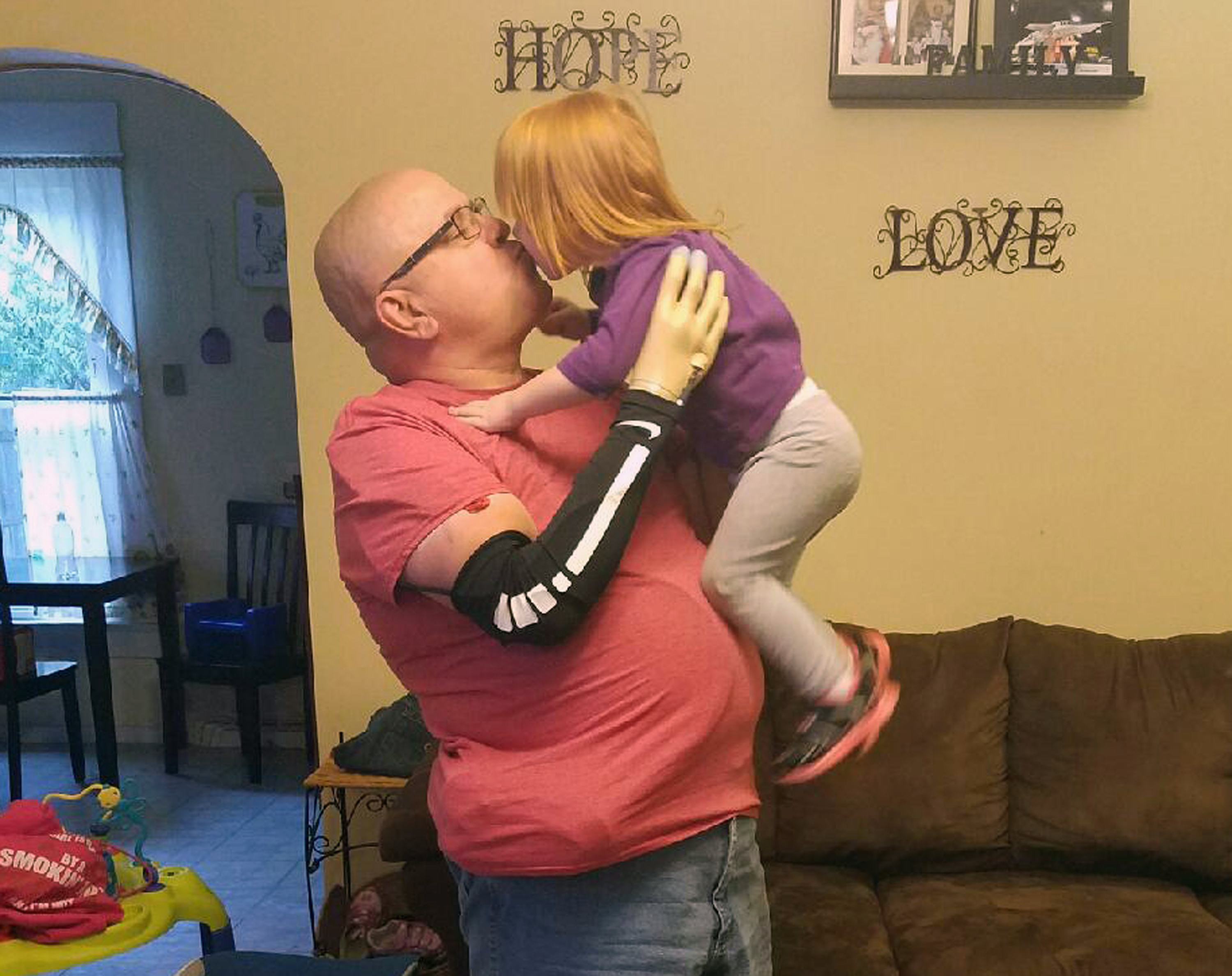 Artificial hand helps amputees feel just how hard to squeeze