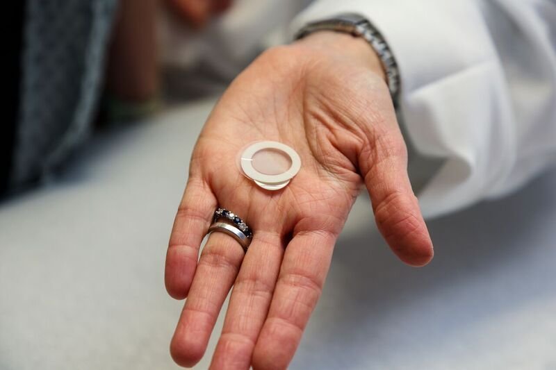 Study: Skin patch could help kids with peanut allergies