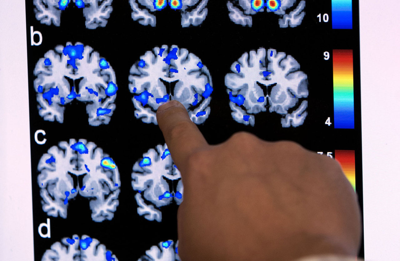 Jace King points to the "reward" area of the brain at the Imaging & Neurosciences Center in Salt Lake City on Wednesday, Nov. 23, 2016. Photo: Laura Seitz, Deseret News