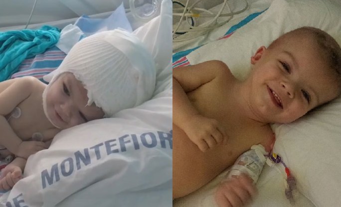 Saving the twins: Health scares and rehab for once-conjoined boys