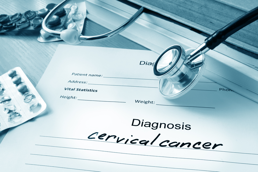 What is cervical cancer and how do you prevent it?