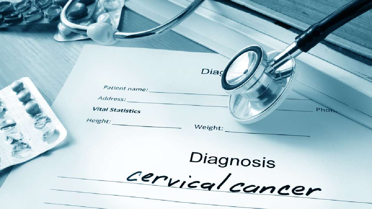 What is cervical cancer and how do you prevent it?