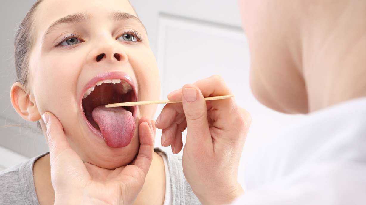 Should children get their tonsils removed? 2 new studies weigh in