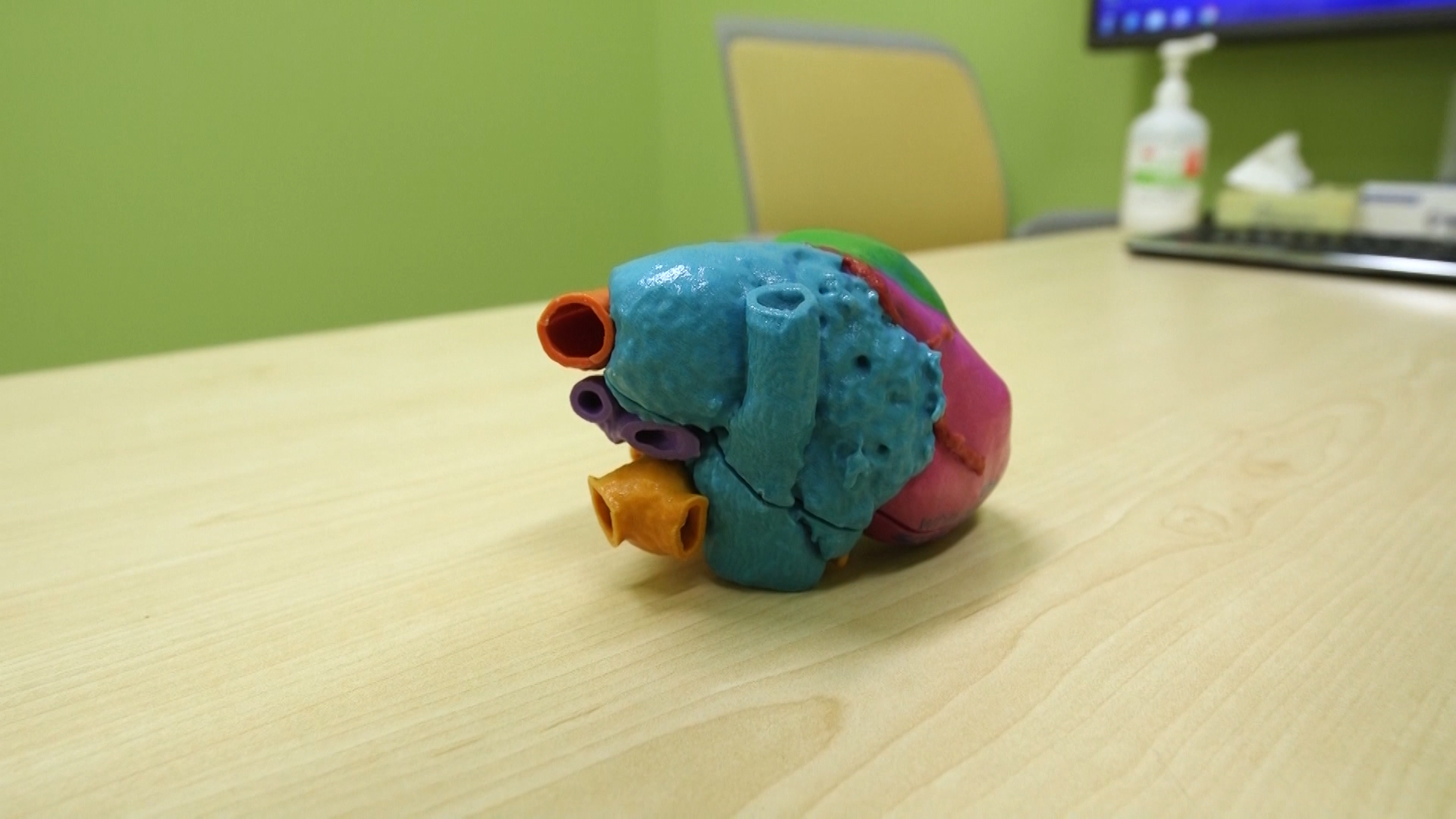 An Orem baby was born with a heart condition so rare her cardiologist had never seen it before. Facing a life-saving surgery, doctors turned to 3-D printing to practice before they started cutting. It was the first time in Utah for a pediatric case. (KSL TV)