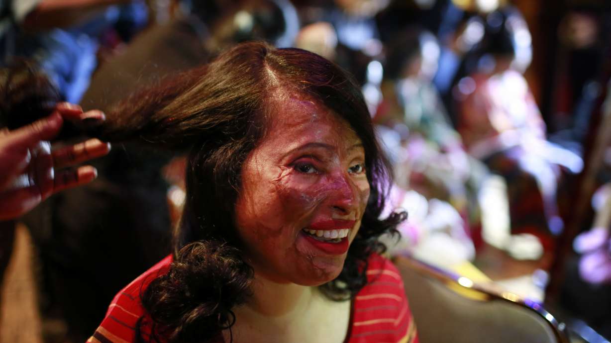Acid victims redefine beauty in Bangladesh fashion show