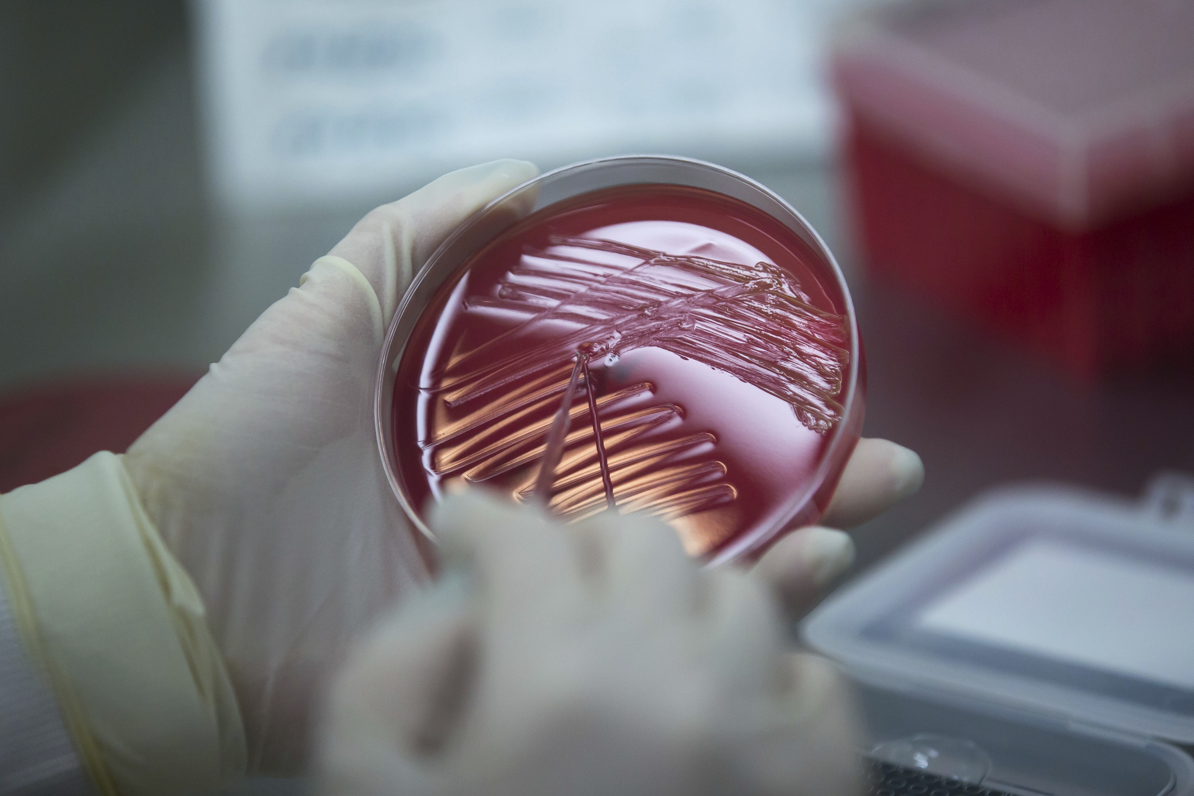 GOP health bill would cut CDC's $1B disease fighting fund