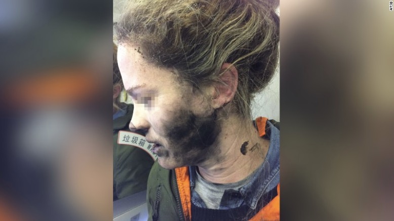 Airline passenger's headphones catch fire midflight
