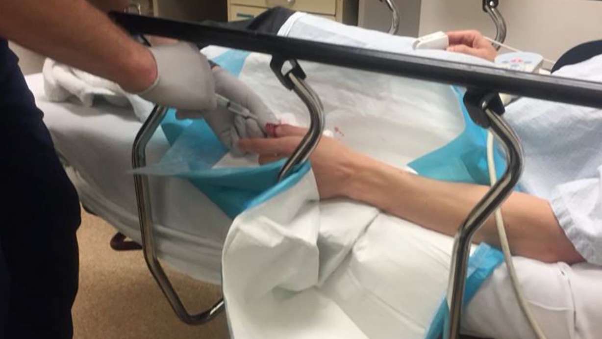 Logan Young lost a thumbnail when he was bit by a neighbor's dog that ran inside his Orem apartment Sunday, April 16, 2017. (Photo: Sam Penrod, KSL TV)