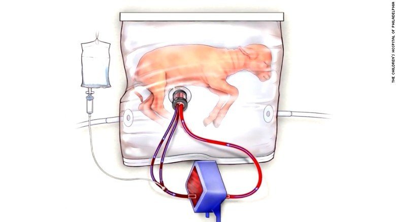 A polythene bag with an umbilical cord interface was used to keep premature lambs alive. (Photo: Children's Hospital of Phil. via CNN)