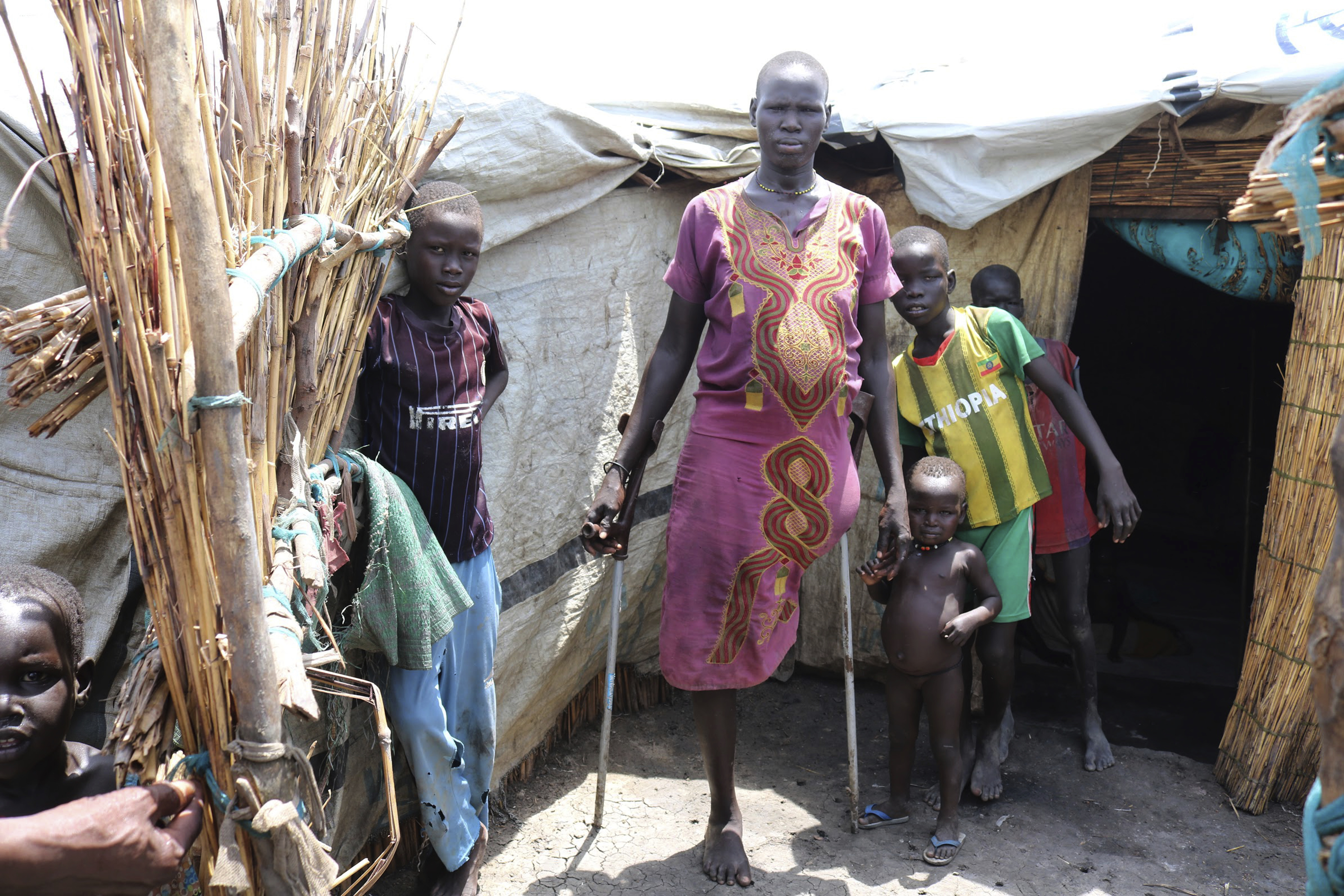 South Sudan's war leaves disabled, elderly at special risk
