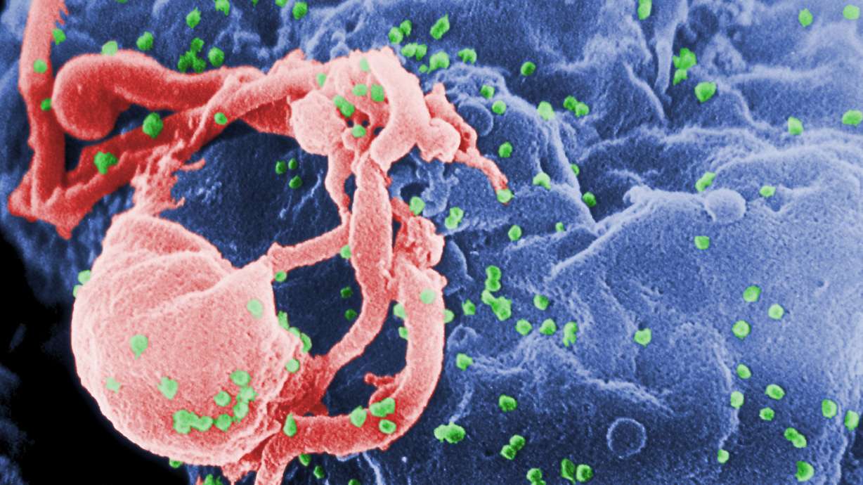 Girl's HIV infection seems under control without AIDS drugs