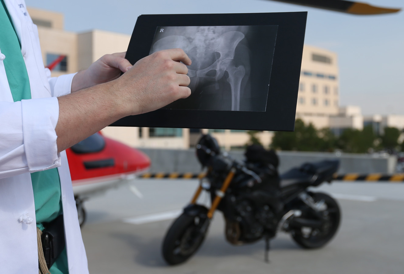 Dr. Dave Morris, a trauma surgeon at Intermountain Medical Center, shows an X-ray of a broken pelvic bone as he talks about the advantages of motorcyclists who wear proper safety gear during a press conference at the Murray hospital on Wednesday, Aug. 2, 2017. (Photo: Laura Seitz, Deseret News)