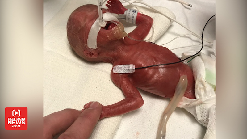 Kaio Doxey Sr. holds his son’s hand moments after he was born. (Photo: Courtesy Doxey family)