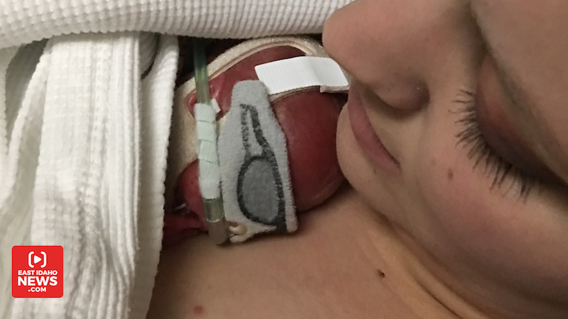 Jessica Doxey was able to hold her son when he was 8 days old. (Photo: Courtesy Doxey family)