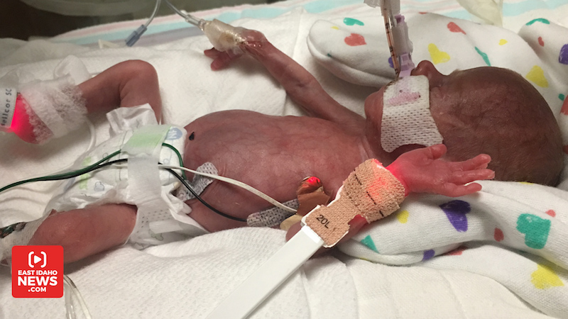 Nampa's '$2 million baby' thrives after lifesaving infusion