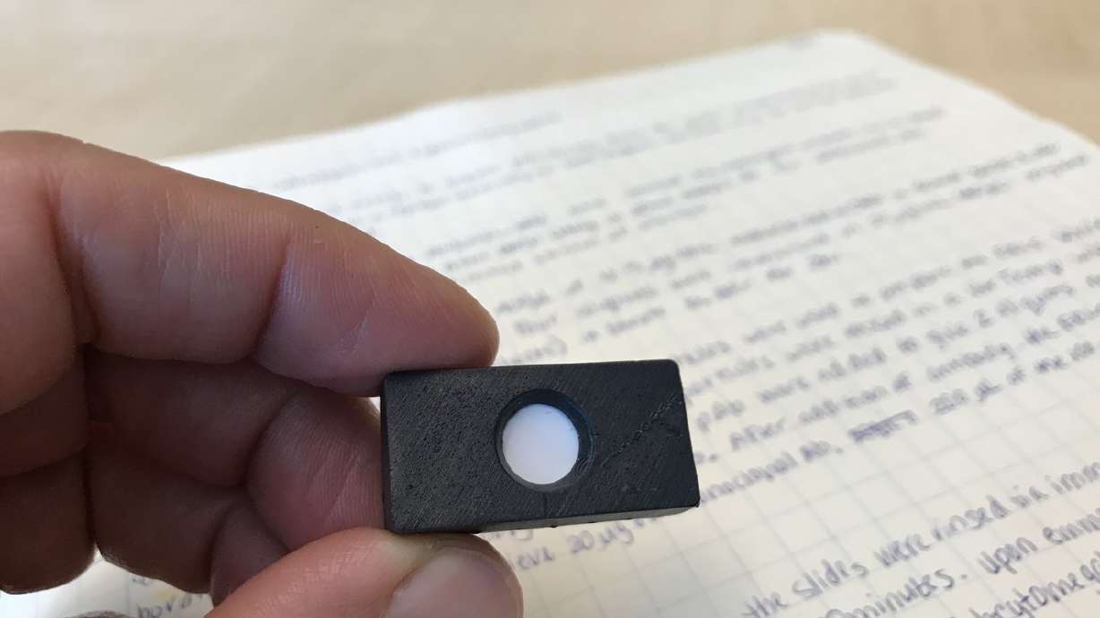 U. researchers developing rapid, cheap liver cancer test