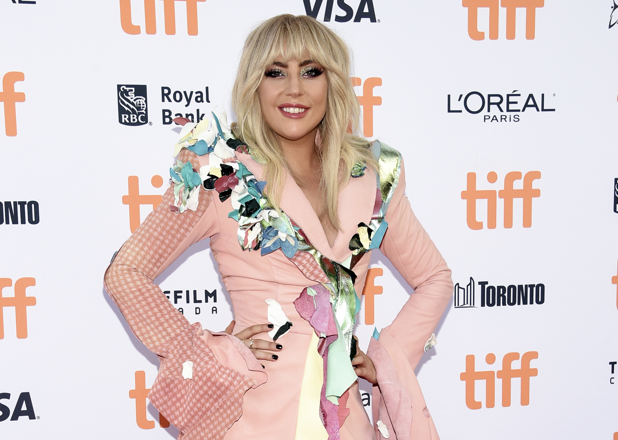 Gaga pulls out of Rock in Rio, posts photo of IV in her arm