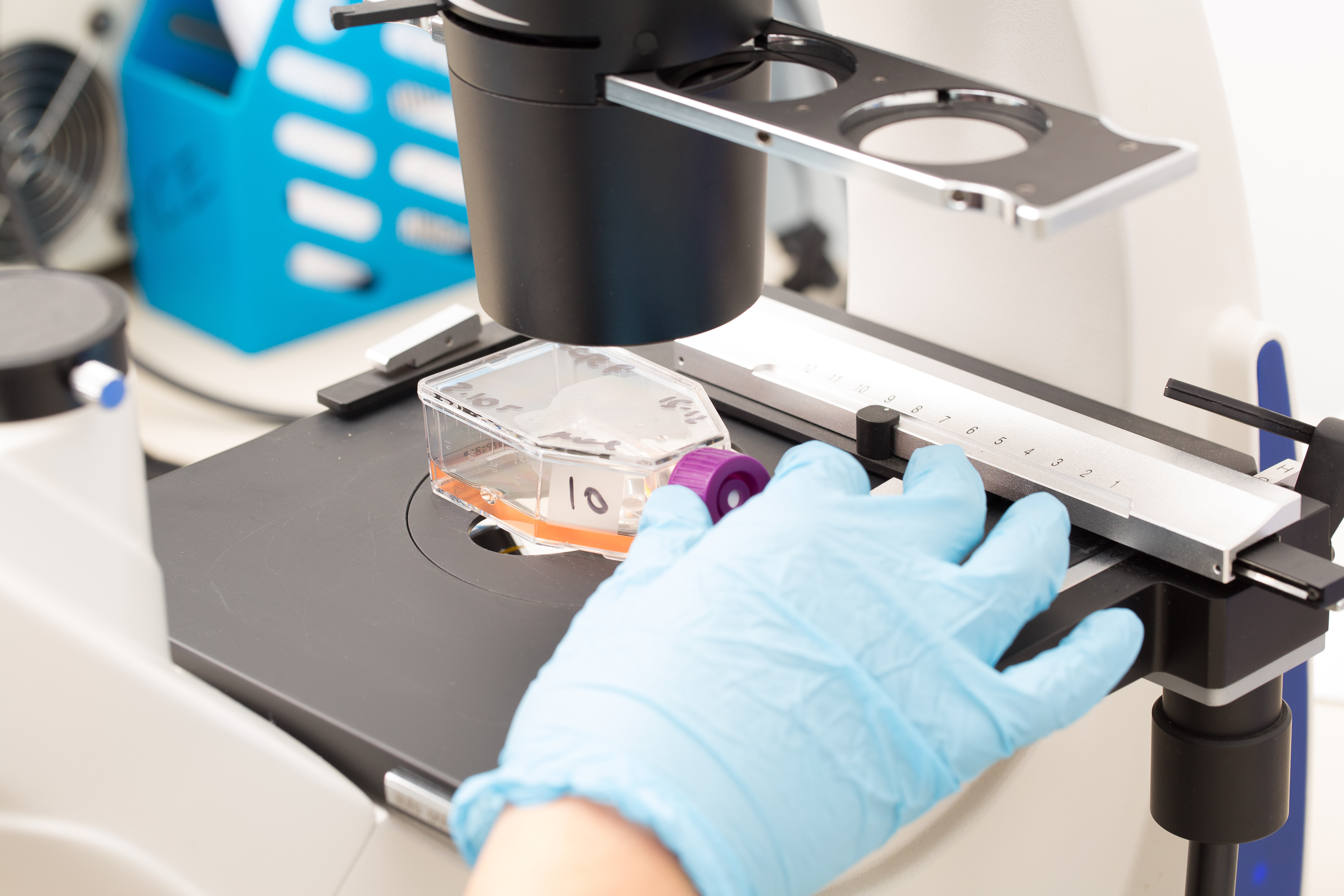 Utah researchers find that fat fuels cancer