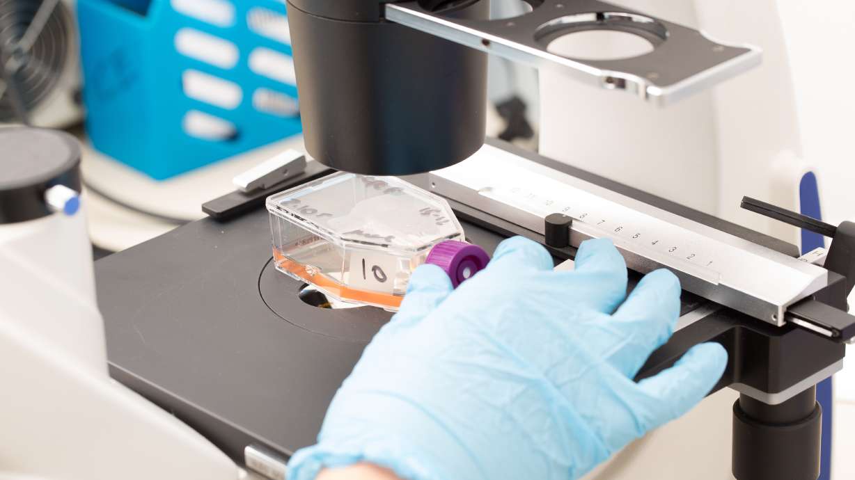 Utah researchers find that fat fuels cancer