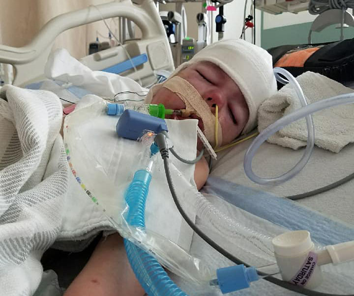Parker Dollinger, age 3, has been put into a medically induced coma. His family fled Beaumont, Texas ahead of Hurricane Harvey. (Photo: Courtesy of Amber Dollinger)