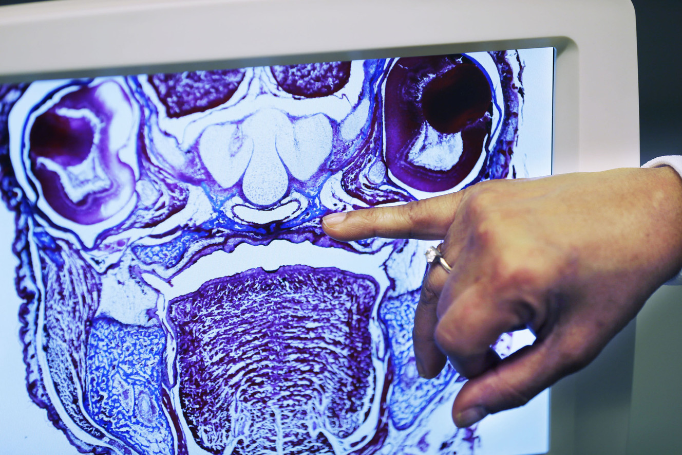 Dr. Rena D'Souza shows a cross section of a mouse embryo at the D'Souza Lab at the University of Utah in Salt Lake City on Friday, Sept. 15, 2017. The slide shows a completely fused cleft palate following treatment. (Photo: Ravell Call, Deseret News)