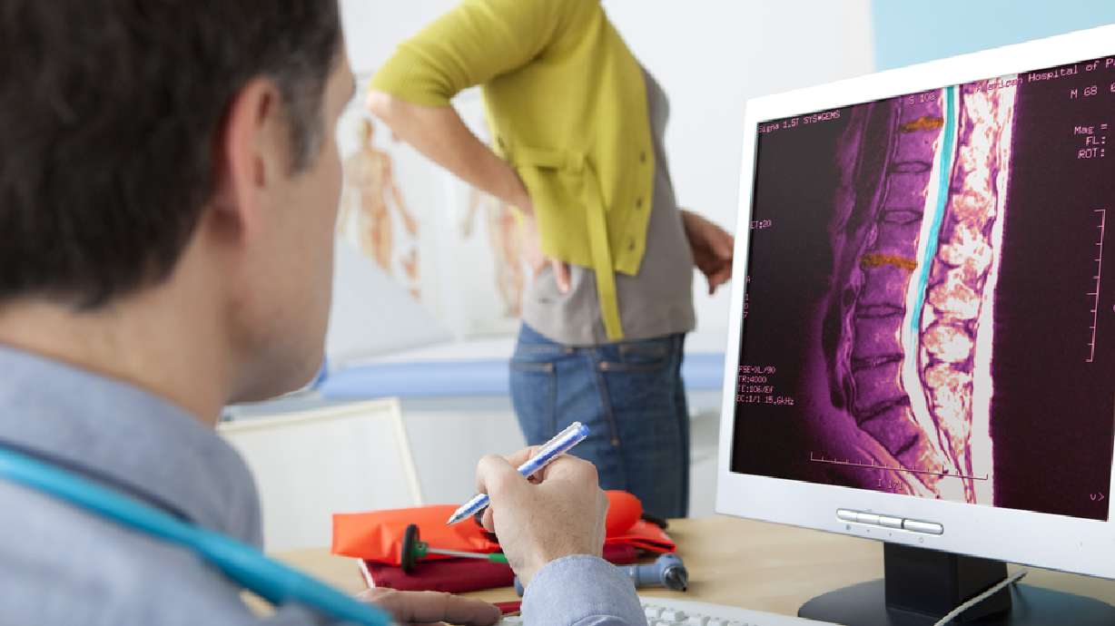 How a robotic “assistant” perfects spinal fusions