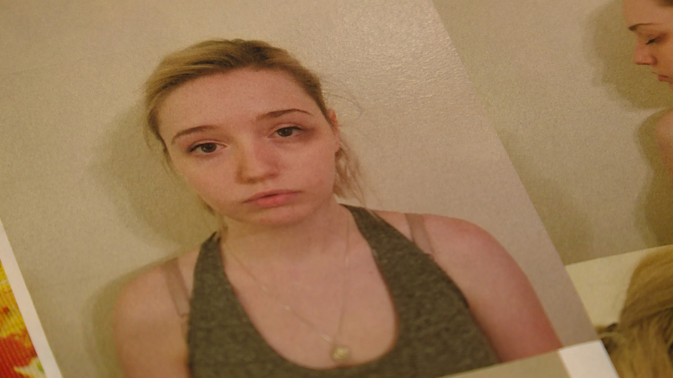 A photo shows the bruises on Kaitlynne Jones after an 18-minute attack from a patient with special needs. (Photo: Tanner Siegworth, KSL)